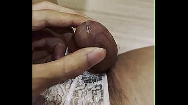 Super glued my penis